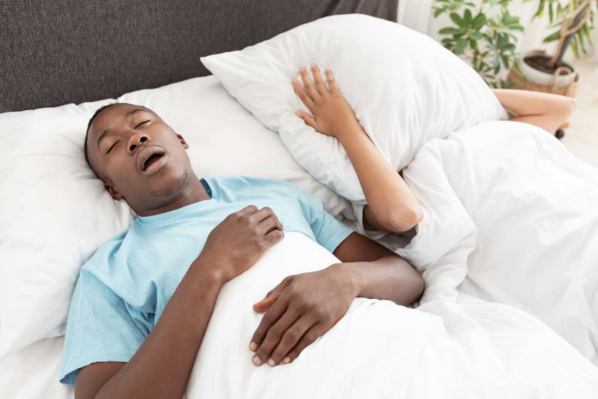 La apnea del sueño es un trastorno del sueño caracterizado por interrupciones en la respiración durante el sueño, que pueden durar desde unos pocos segundos hasta minutos, varias veces por hora