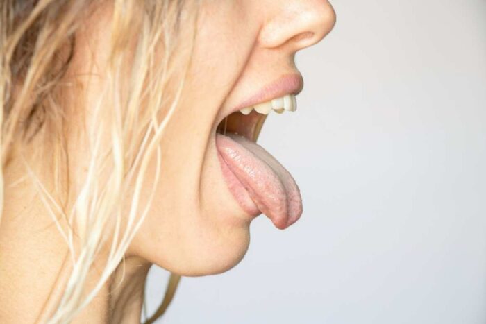 El aspecto cremoso de manchas blancas en tu lengua puede ser sinónimo de una enfermedad conocida como candidiasis oral.