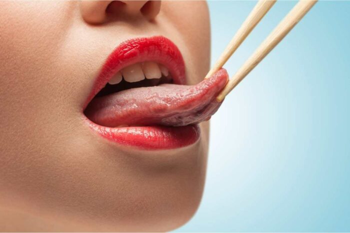 Una lengua con apariencia de fresa, es decir roja, brillante y con salpullido puede se síntoma de enfermedades como el Kawasaki.
