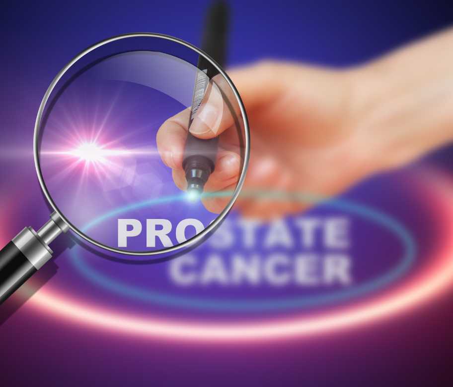 Cáncer de próstata: importancia de la revisión precoz para prevenirlo